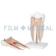 Dental Models